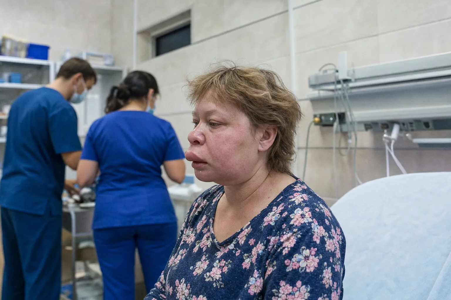 Риск ангионевротического отека при приеме ингибиторов АПФ